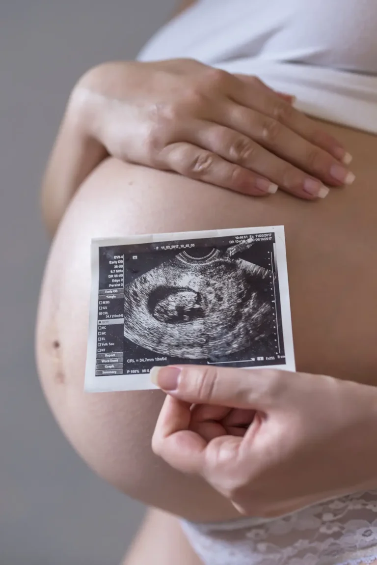 pregnant woman holding photo her future baby