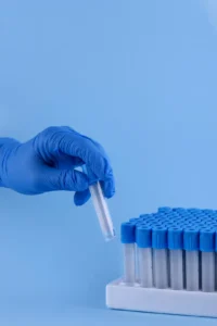 Hand wearing medical glove delicately holding a vial - Dream IVF Cyprus, Ensuring Precision and Care in Fertility Treatment